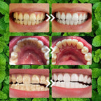 🔥 Oralhoo Teeth Restoration Mineral Powder – مسحوق ترميم الأسنان أورالهو
