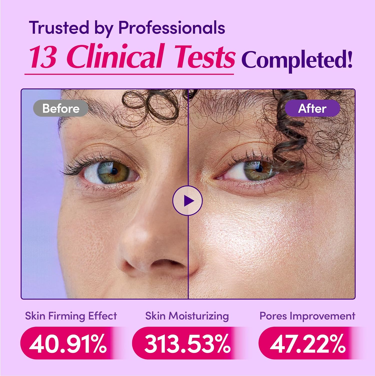Luxury Bakuchiol Plumping Serum – سيروم باكوشيول لتعبئة ونضارة البشرة