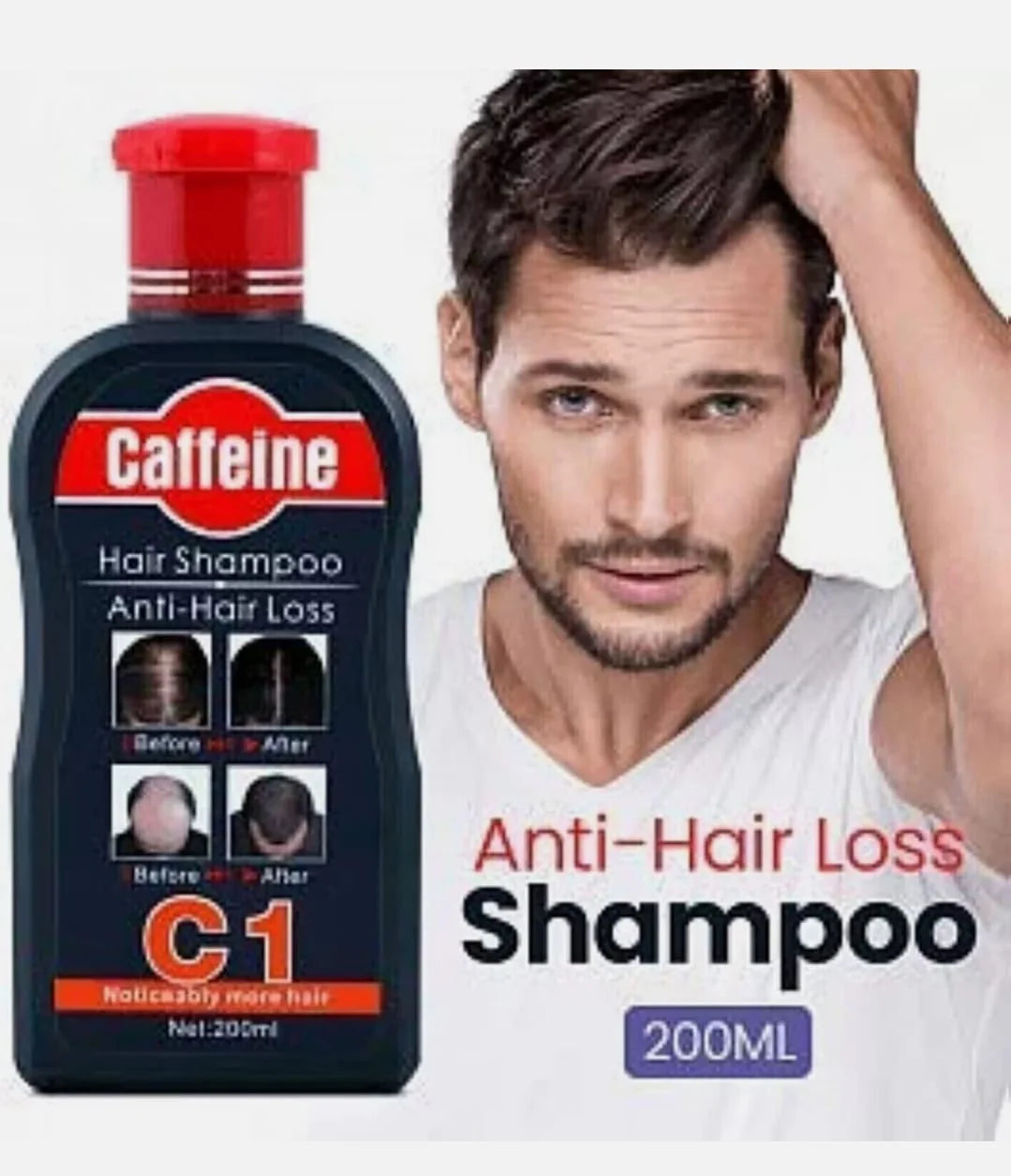 🔥 Caffeine Hair Shampoo – شامبو بالكافيين لتقوية الشعر