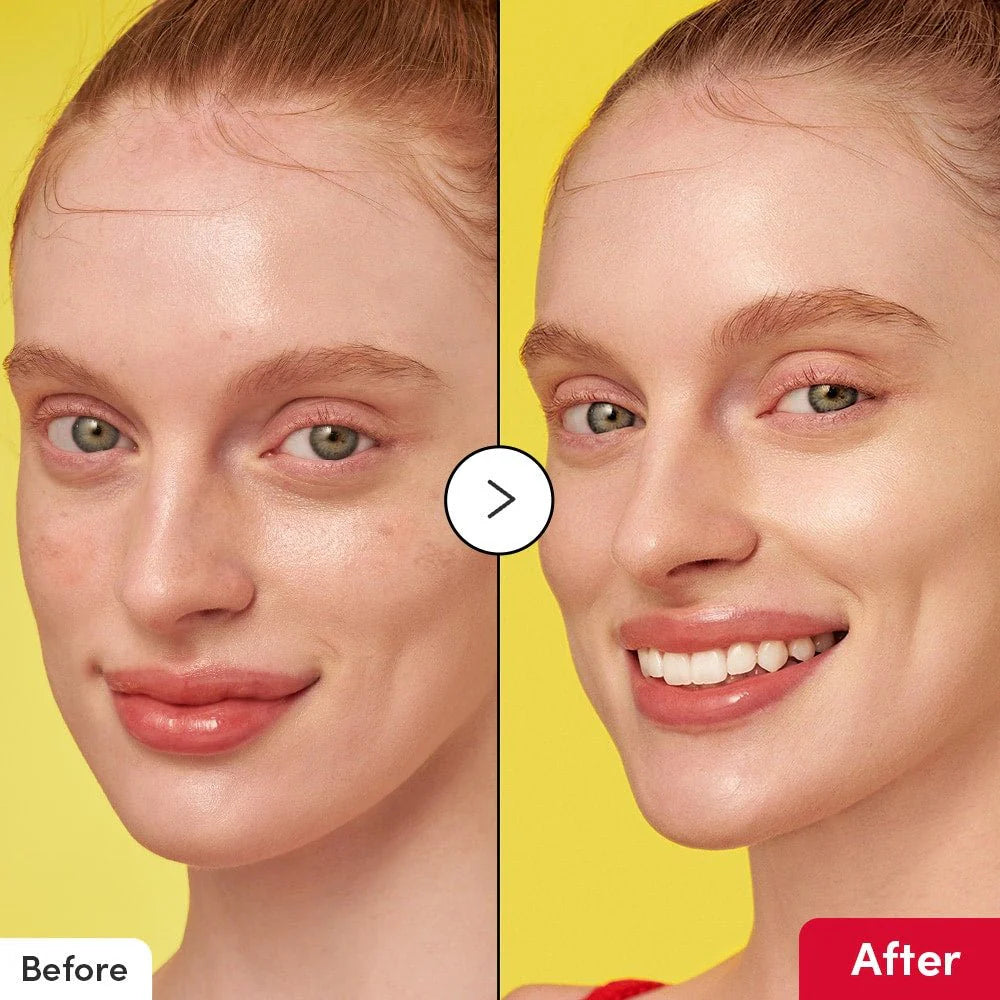 Luxury Bakuchiol Plumping Serum – سيروم باكوشيول لتعبئة ونضارة البشرة