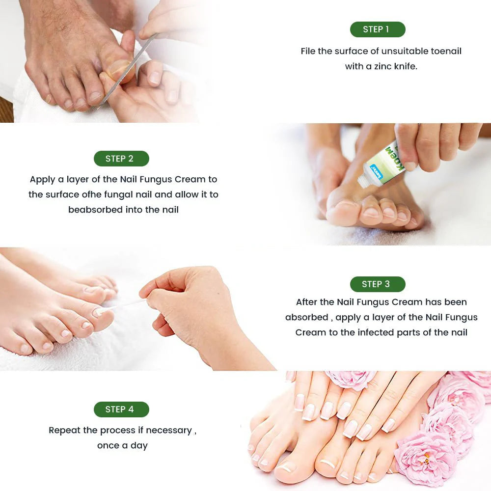 🔥 Sumifun Nail Treatment Repair Gel – جل علاج الأظافر سُمِيفن الأصلي