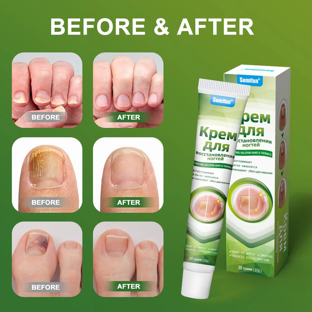🔥 Sumifun Nail Treatment Repair Gel – جل علاج الأظافر سُمِيفن الأصلي