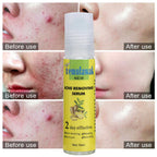🔥 Temulawak New Acne Removing Serum – سيروم تمولاواك لازالة حبّ الشباب