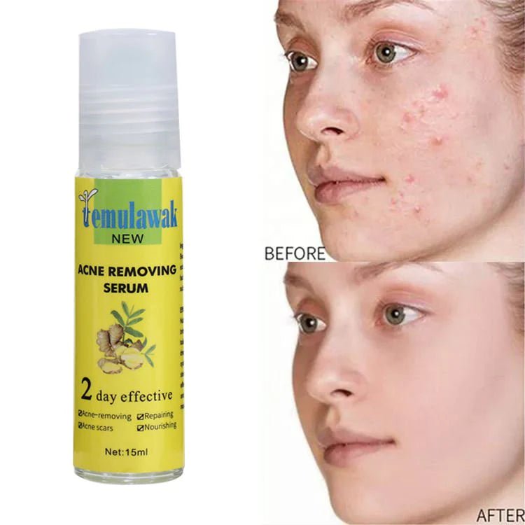 🔥 Temulawak New Acne Removing Serum – سيروم تمولاواك لازالة حبّ الشباب